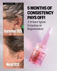 Hair serum Global system - Calecim Professional - EIDEAL