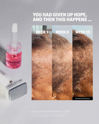 Hair serum Global system - Calecim Professional - EIDEAL