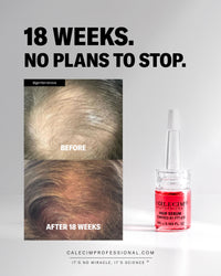Hair serum Global system - Calecim Professional - EIDEAL