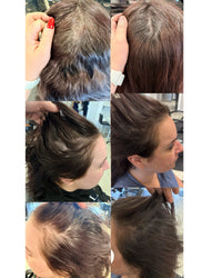 Hair serum Global system - Calecim Professional - EIDEAL